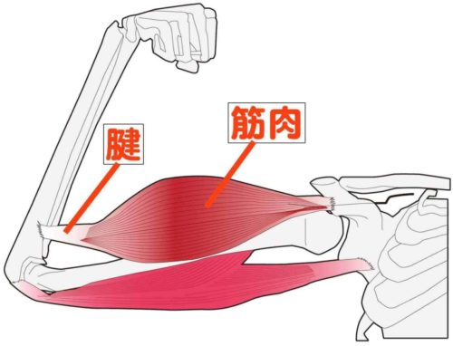 自分で治す! 腱鞘炎 | 高林 孝光 |本 | 通販 | Amazon