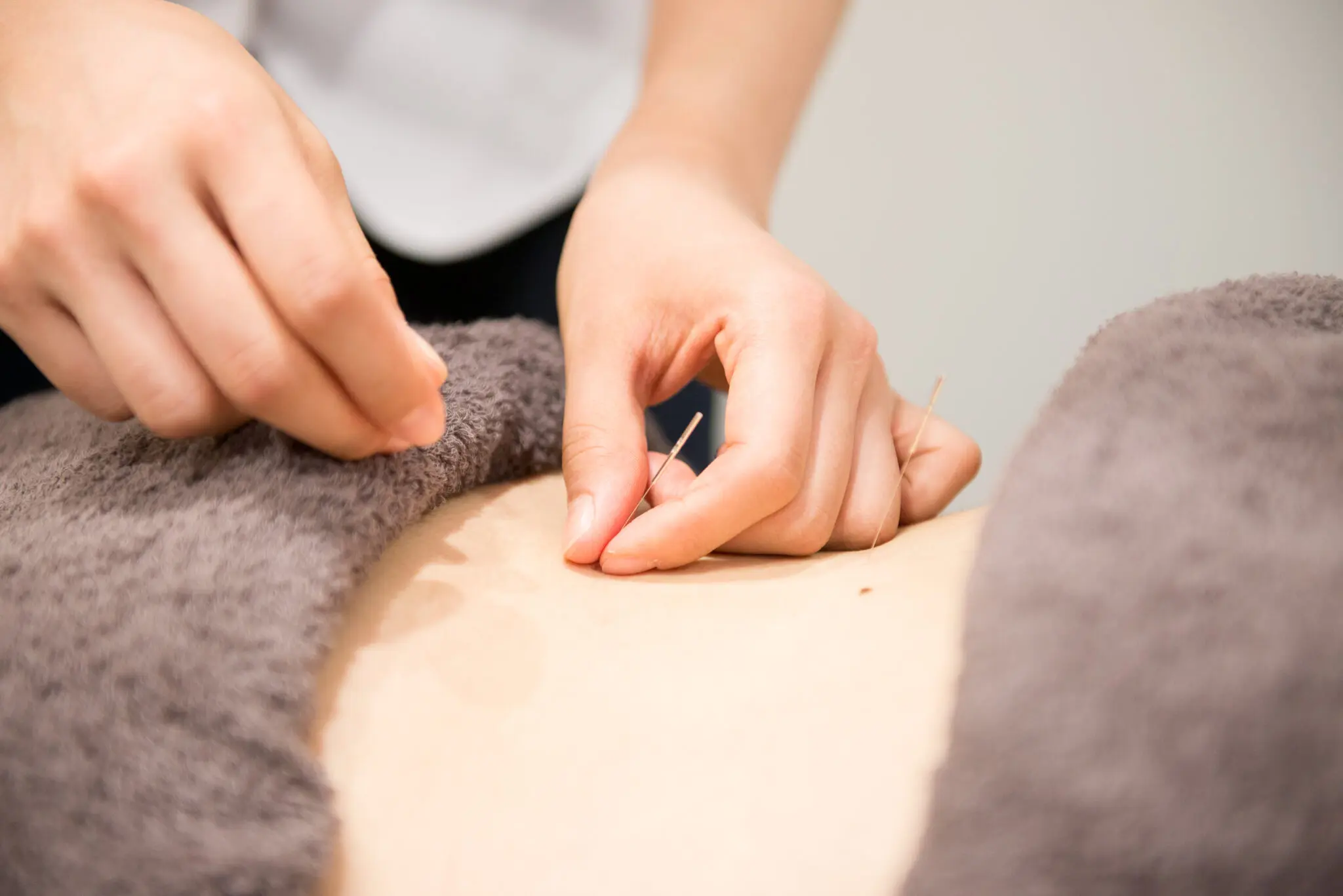 鍼灸施術/コレド室町テラス院/ReCORE鍼灸接骨院